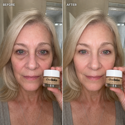 OcuBalm™ All In One Under Eye Balm