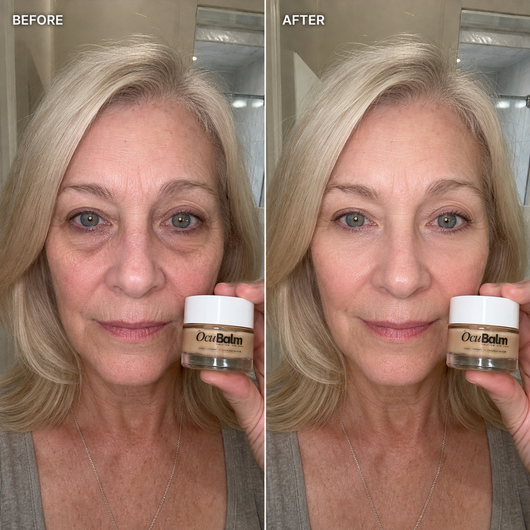 OcuBalm™ All In One Under Eye Balm
