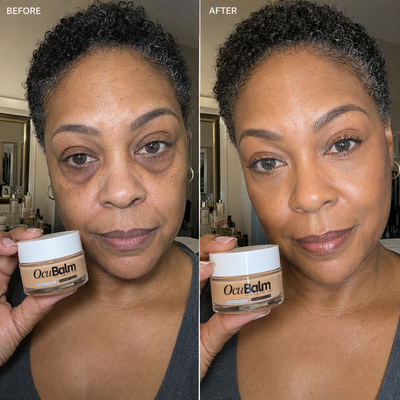 OcuBalm™ All In One Under Eye Balm