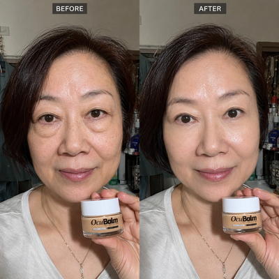 OcuBalm™ All In One Under Eye Balm