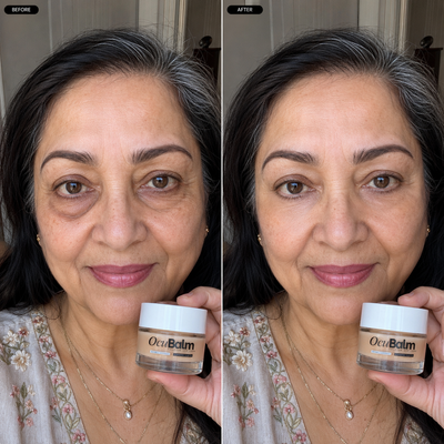 OcuBalm™ All In One Under Eye Balm